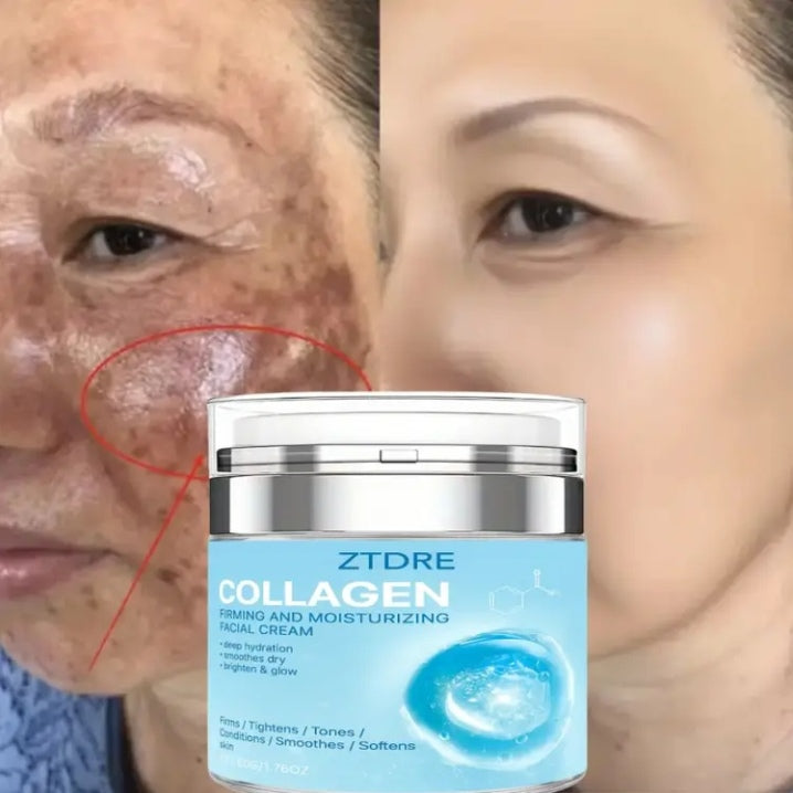 ZTDRE collagen