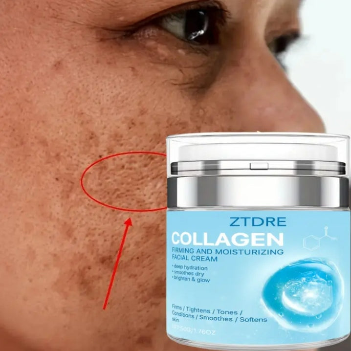 ZTDRE collagen