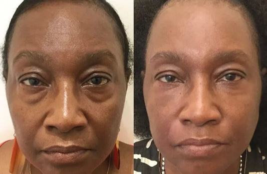 Snyeq firm tightening - lift eye cream