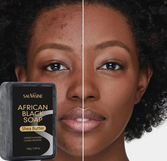 African Black Soap