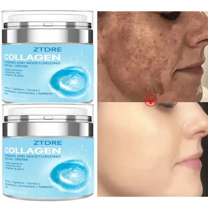 ZTDRE collagen