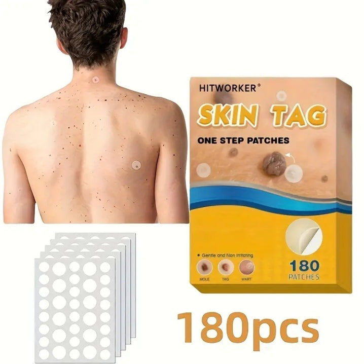 Skin tag