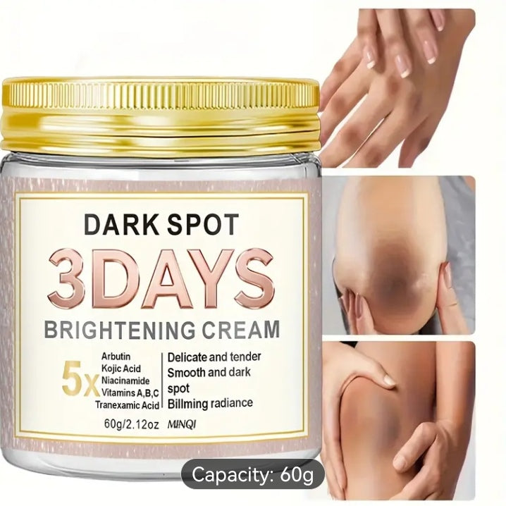 Dark spots removal cream