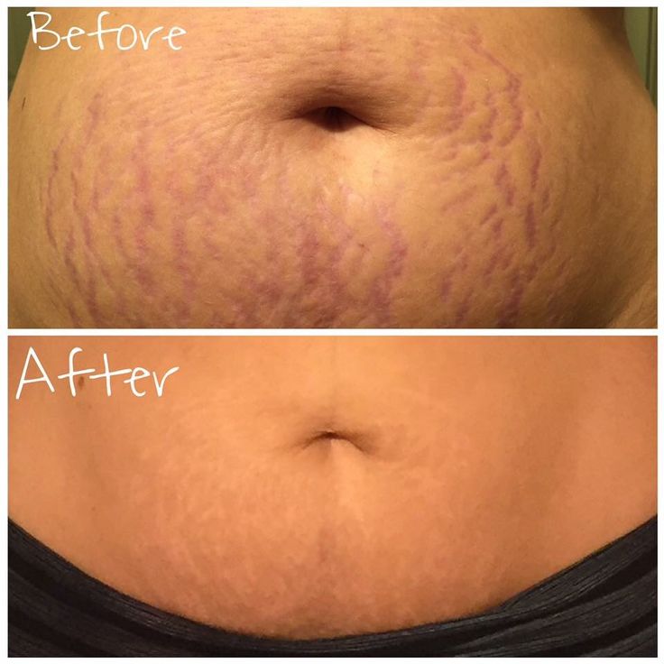 MALIYYA Firming Body Cream