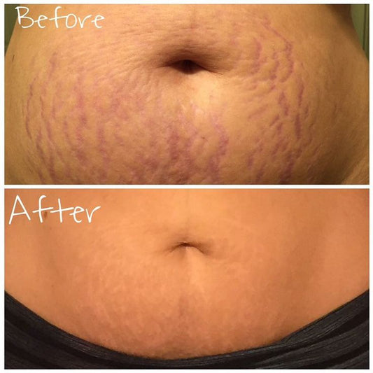 MALIYYA Firming Body Cream